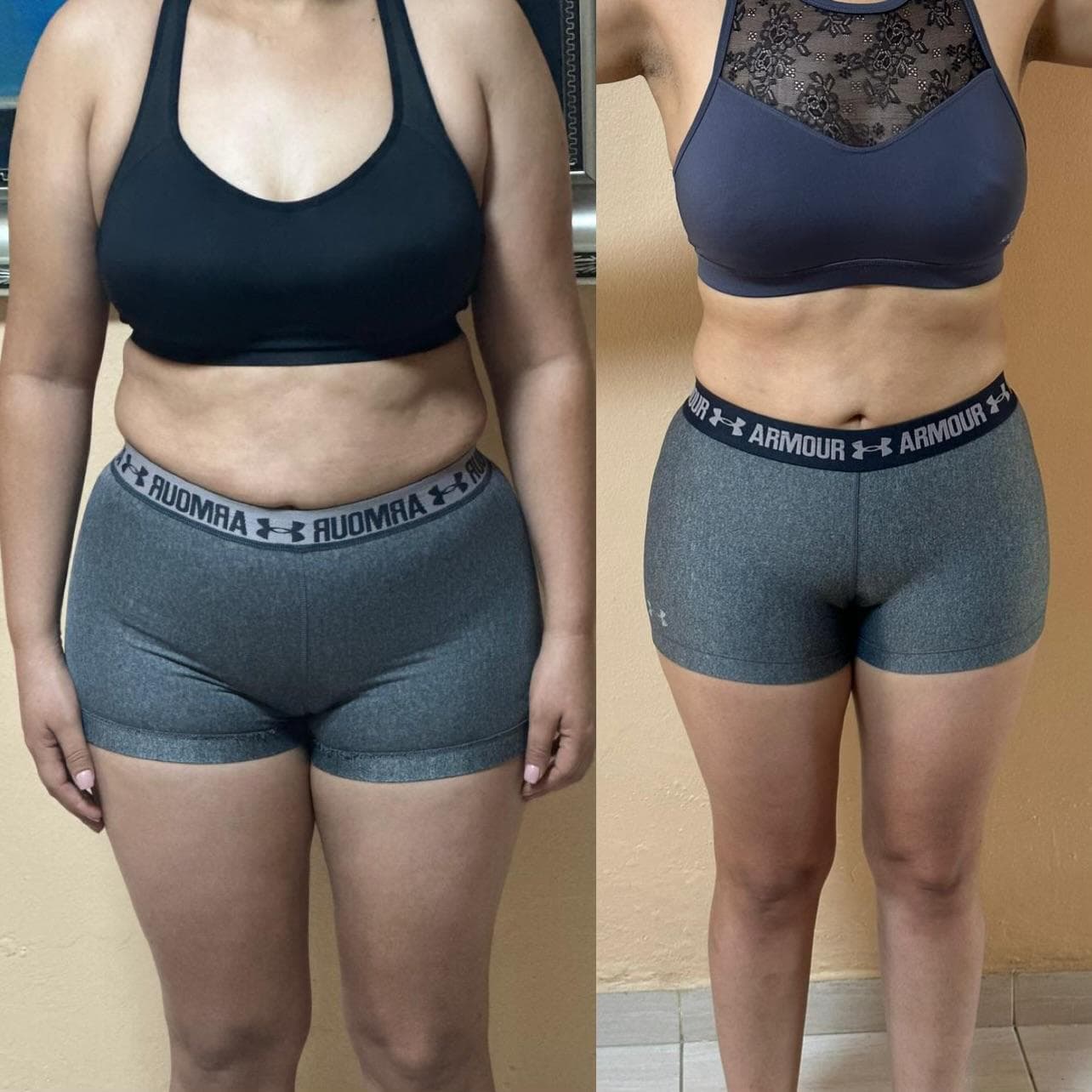 Antes y después de Leidy, -6kg en 1 mes