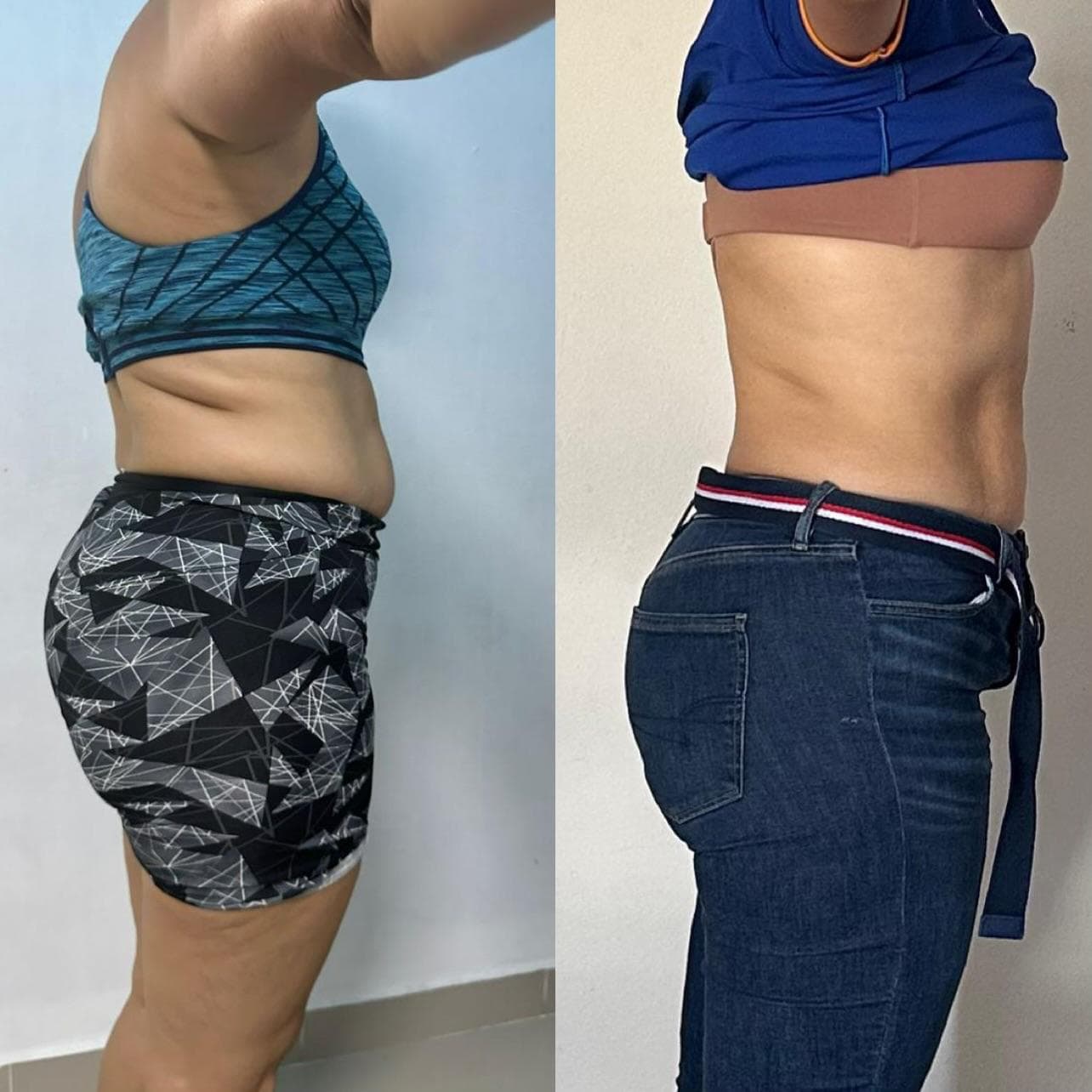 Antes y después de Lorena, -7kg en 2 meses