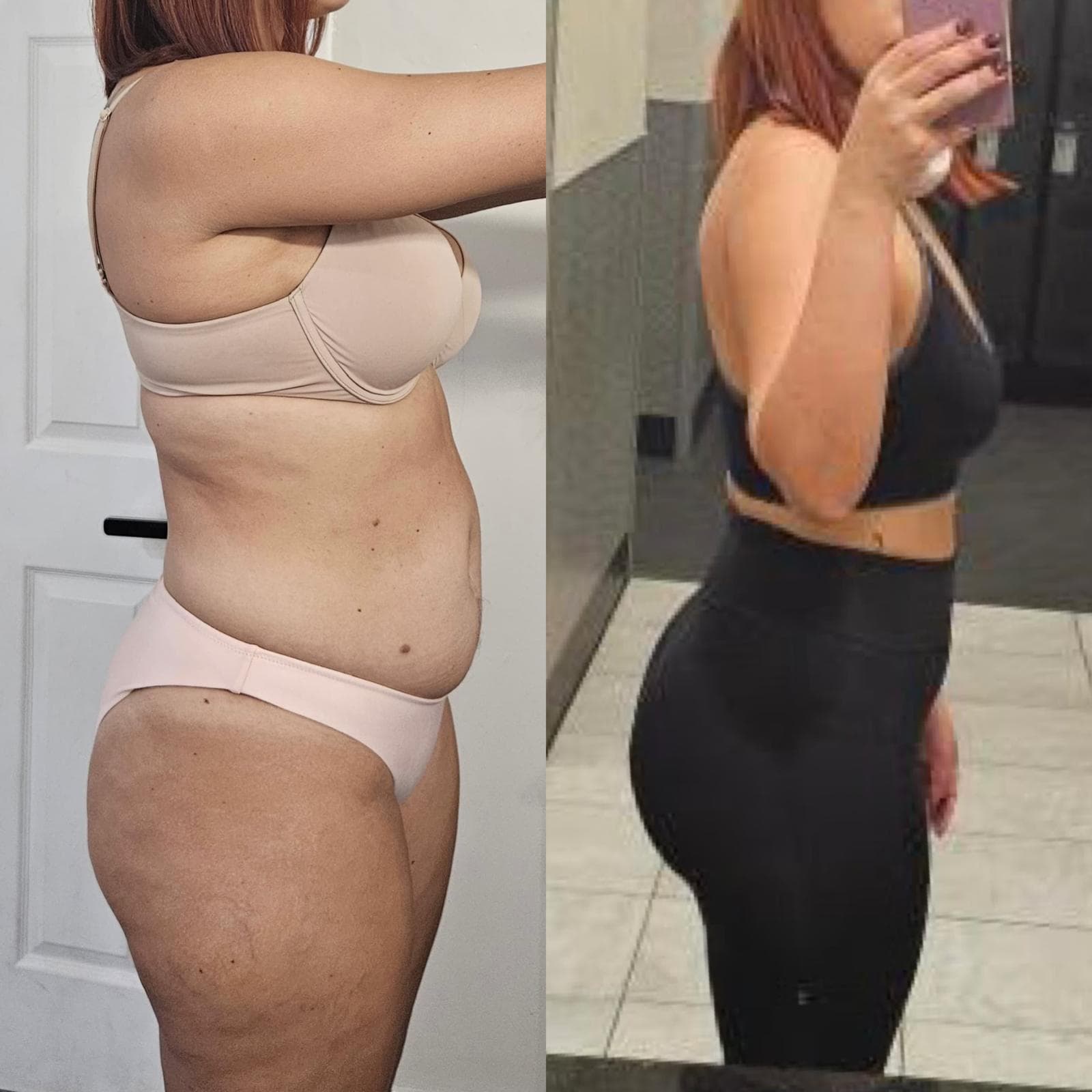 Antes y después de Rosa, -7kg en 3 meses